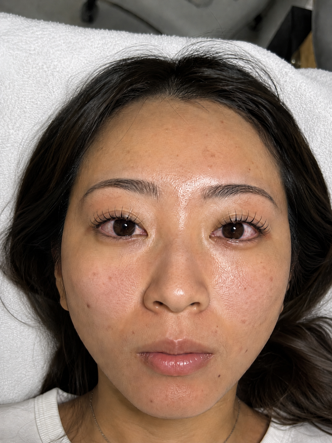 目元美人加工前のアイラッシュ施術写真